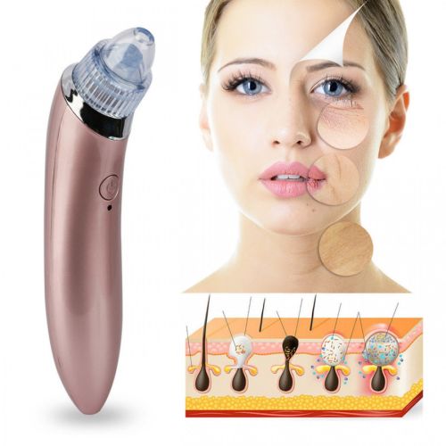 Вакуумний апарат для обличчя Beauty Skin Care Specialist XN-8030 пристрій очищувач, апарат-Очищувач пір для видалення акне, чищення шкіри