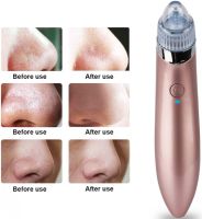 Вакуумний апарат для обличчя Beauty Skin Care Specialist XN-8030 пристрій очищувач, апарат-Очищувач пір для видалення акне, чищення шкіри