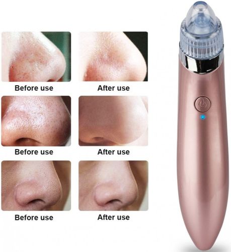 Вакуумний апарат для обличчя Beauty Skin Care Specialist XN-8030 пристрій очищувач, апарат-Очищувач пір для видалення акне, чищення шкіри