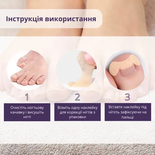 Набір пластирів Elastic Toenail Correction Sticker 50 шт для корекції вростаючих нігтів тілесний пластир наклейка для усунення врослого нігтя