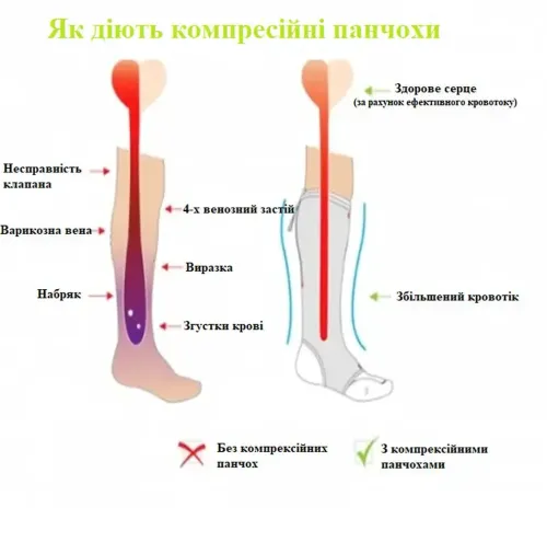 Компресійні гольфи від варикозу Zip Sox, облягаючі лікувальні панчохи, шкарпетки для фіксації щиколоток Зіп Сокс зі змійкою, чорні S / M, L / XL