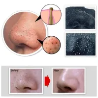 Чорна маска для обличчя Dermacol Black Peel Off Mask в тюбику 120мл. проти вугрів і чорних крапок