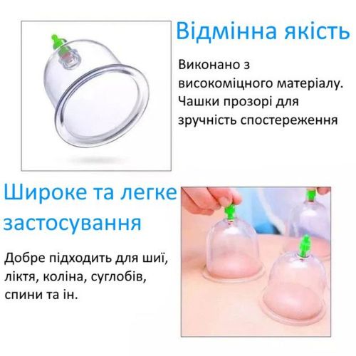Вакуумні масажні антицелюлітні банки з насосом-Pull Out a Vacuum Apparatus KL 24 шт, Медичний набір з 24 вакуумних банок для масажу