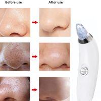 Вакуумний апарат Derma Suction прилад для чищення пір і видалення чорних крапок, пілінг для обличчя, очищувач, апарат-Очищувач шкіри 4 насадки Білий