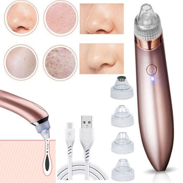 Вакуумний апарат для обличчя Beauty Skin Care Specialist XN-8030 пристрій очищувач, апарат-Очищувач пір для видалення акне, чищення шкіри