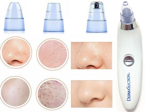 Вакуумний апарат Derma Suction прилад для чищення пір і видалення чорних крапок, пілінг для обличчя, очищувач, апарат-Очищувач шкіри 4 насадки Білий