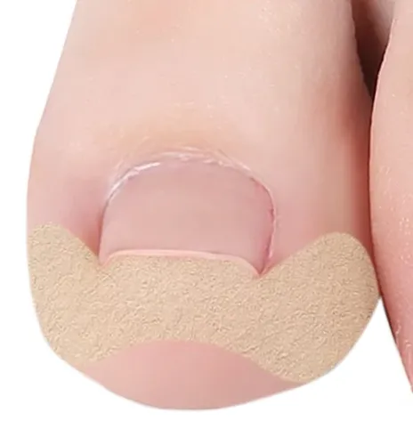 Набір пластирів Elastic Toenail Correction Sticker 50 шт для корекції вростаючих нігтів тілесний пластир наклейка для усунення врослого нігтя